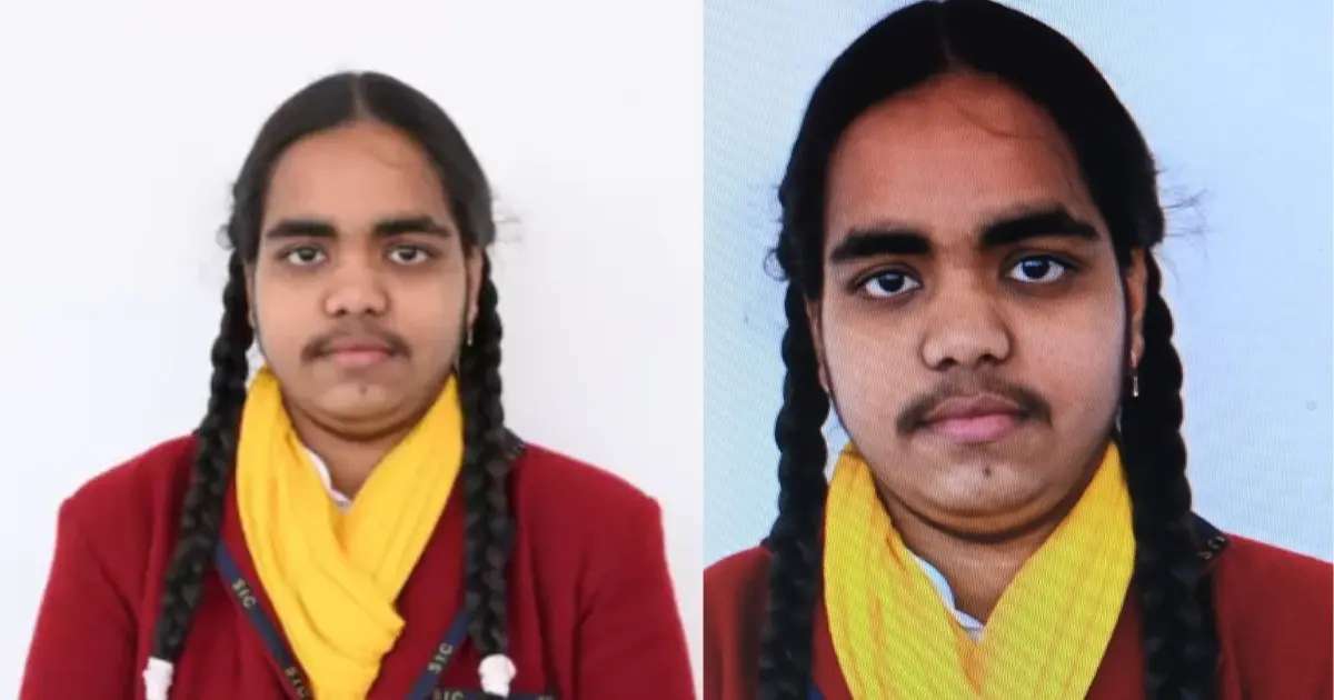 UP Board Class 10 clincher Prachi Nigam, savaged over beard growth, gets support from online local area